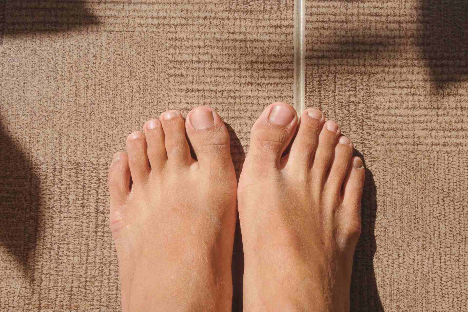 Photo - 1 - When Should I Be Worried About Sock Marks?