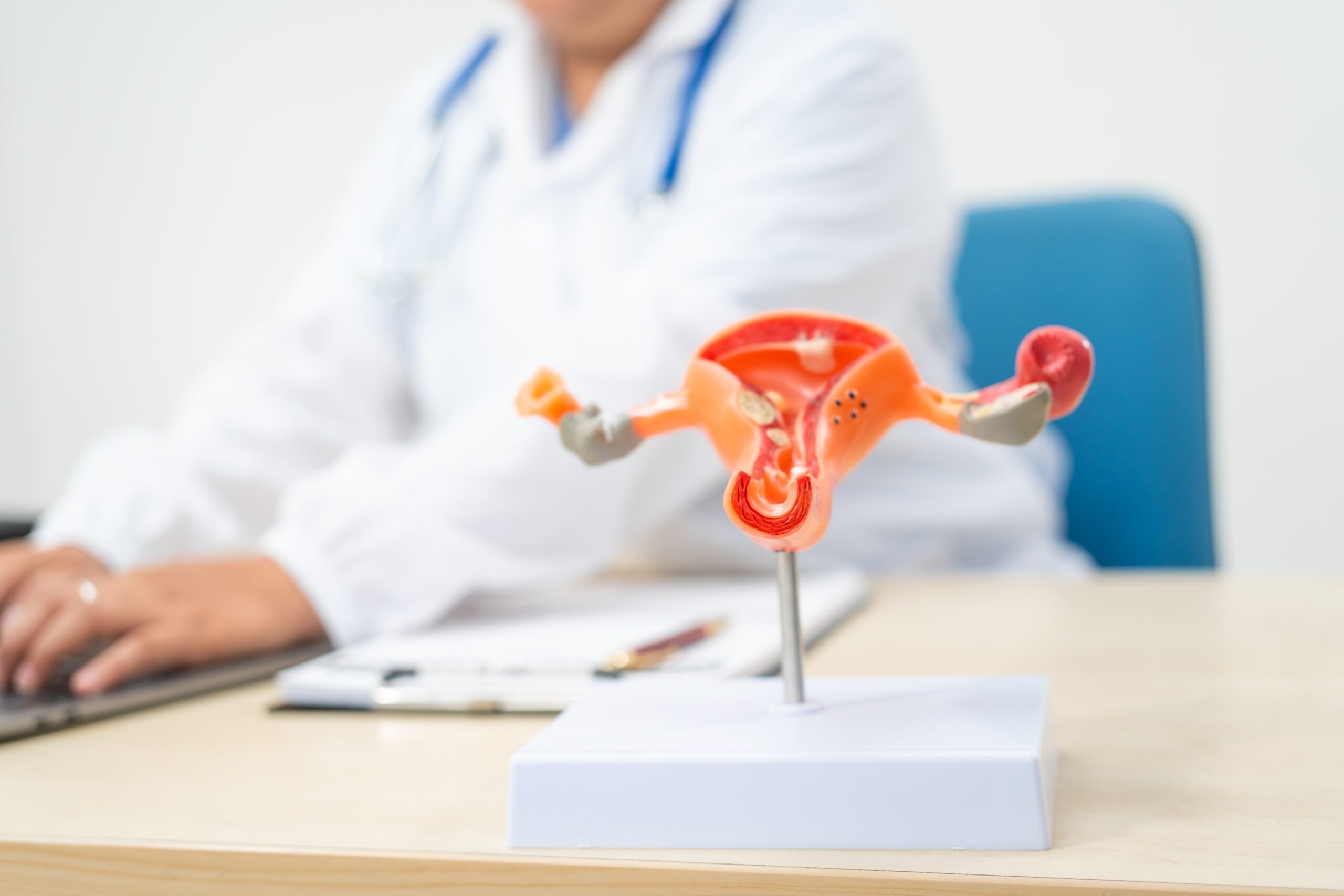 Photo - 0 - Uterine Fibroid Embolization